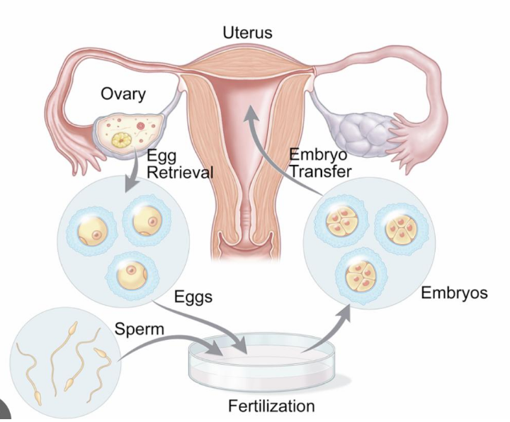 Total Infertility Care